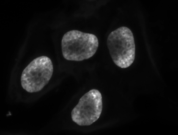 Grayscale and blurred nuclei channel
