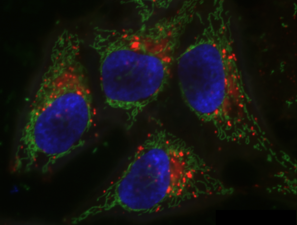 Hela cells image