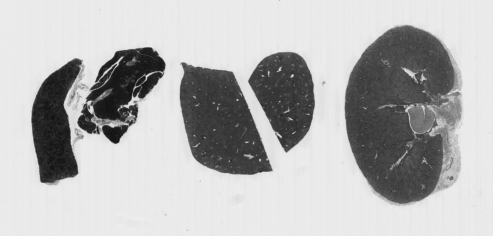 Grayscale H&E image