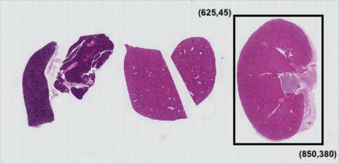 Sub picture coordinates for the kidney tissue section