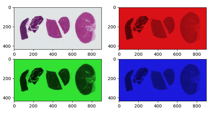 A grid showing each RGB color of the H&E image