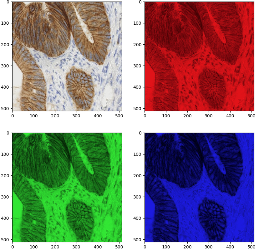 A grid showing each RGB color of the immunohistochemistry image