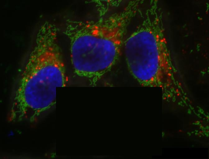 "Erased" one cell from hela cells image