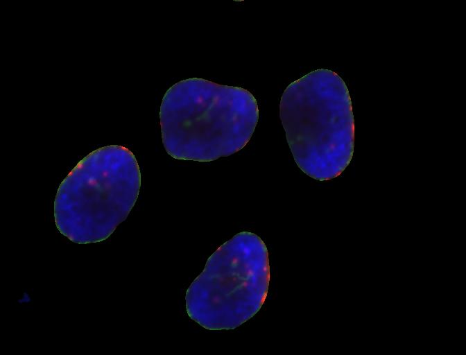 Selected nuclei after applying binary mask to the HeLa cells image