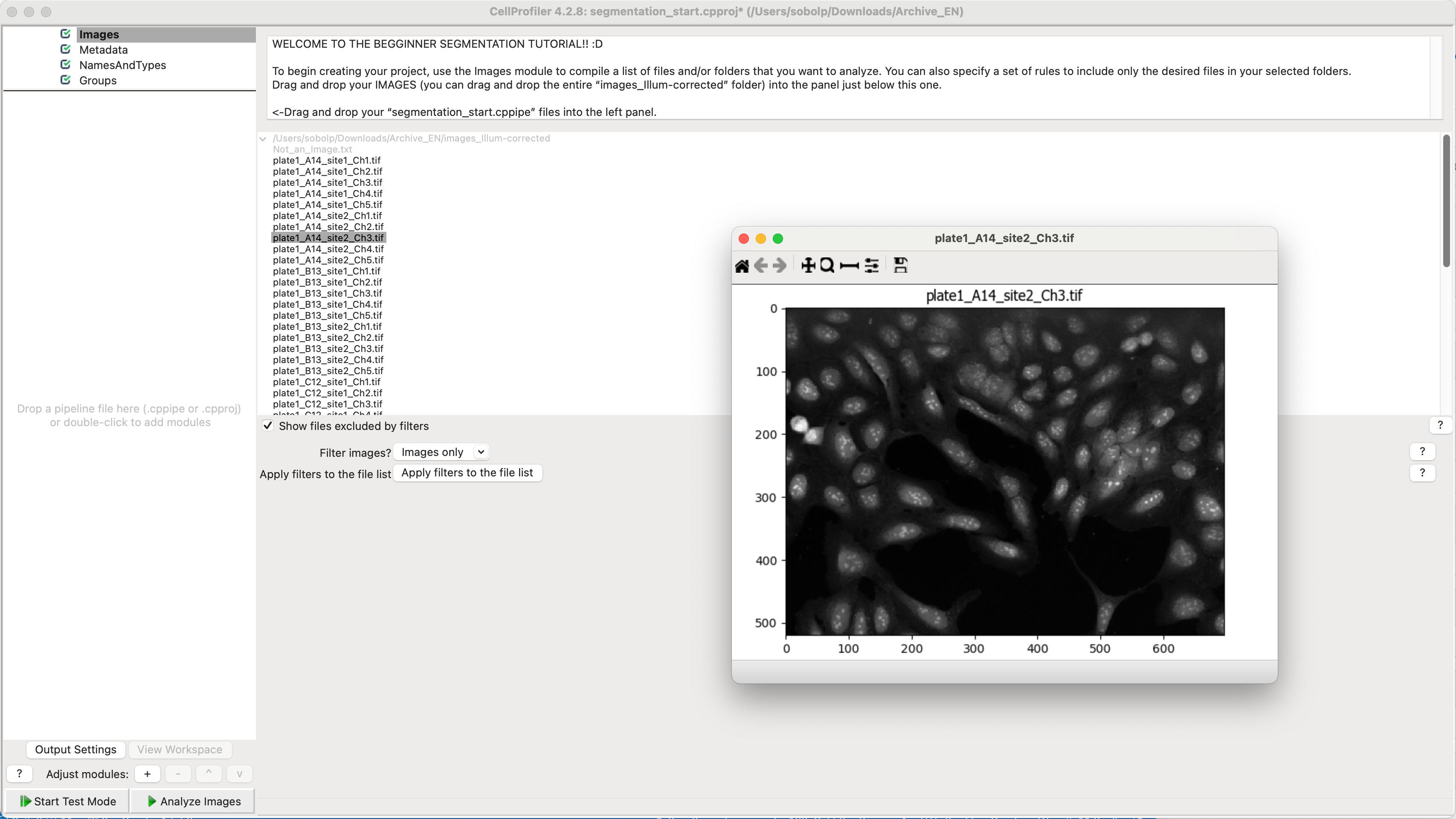 Screenshot of CellProfiler UI with menu bar and the segmentation_start pipeline imported. The image list is populated with images and an example is open.
