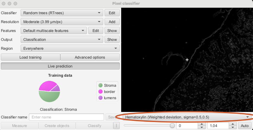 Screenshot of QuPath `Pixel classifier` dialog with the `Show classification` dropdown marked in red and showing a feature.
