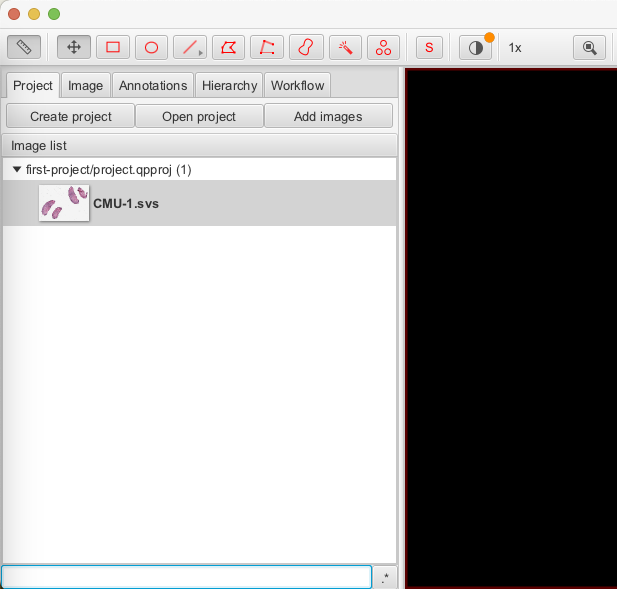 Inset of screenshot of QuPath application window with a single image in the `Analysis pane` Project tab.