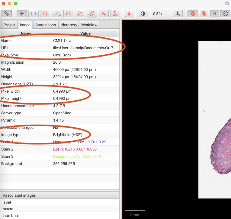 Inset of screenshot of QuPath application window `Analysis pane` with CMU-1.svs image open.
