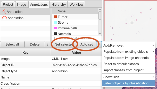 Screenshot of QuPath  application  showing the Annotations tab of the Analysis Pane with the `Set selected` and `Auto set` buttons shown in red.