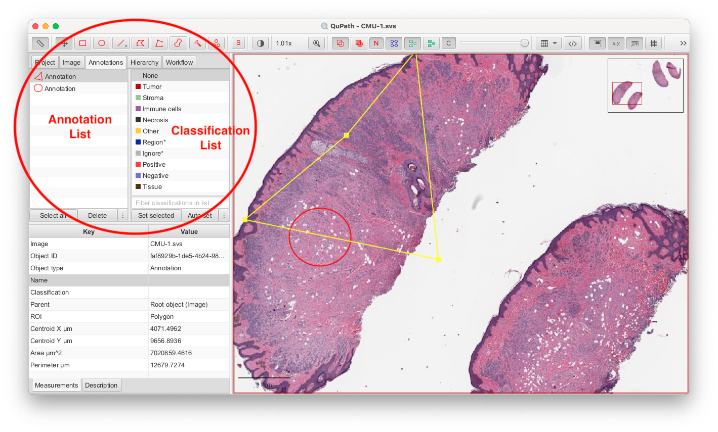 Screenshot of QuPath  application  showing the Annotations tab of the Analysis Pane in red.