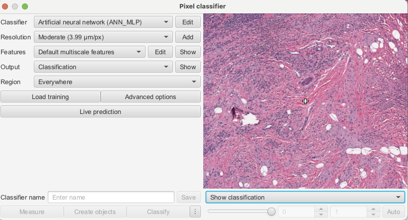Screenshot of QuPath `Pixel classifier` dialog used to train the pixel classifier.