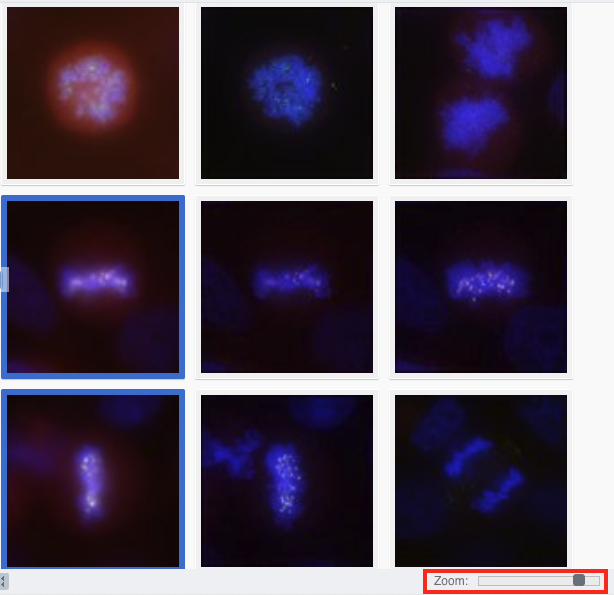 Image thumbnails with metaphase images and zoom slider highlighted